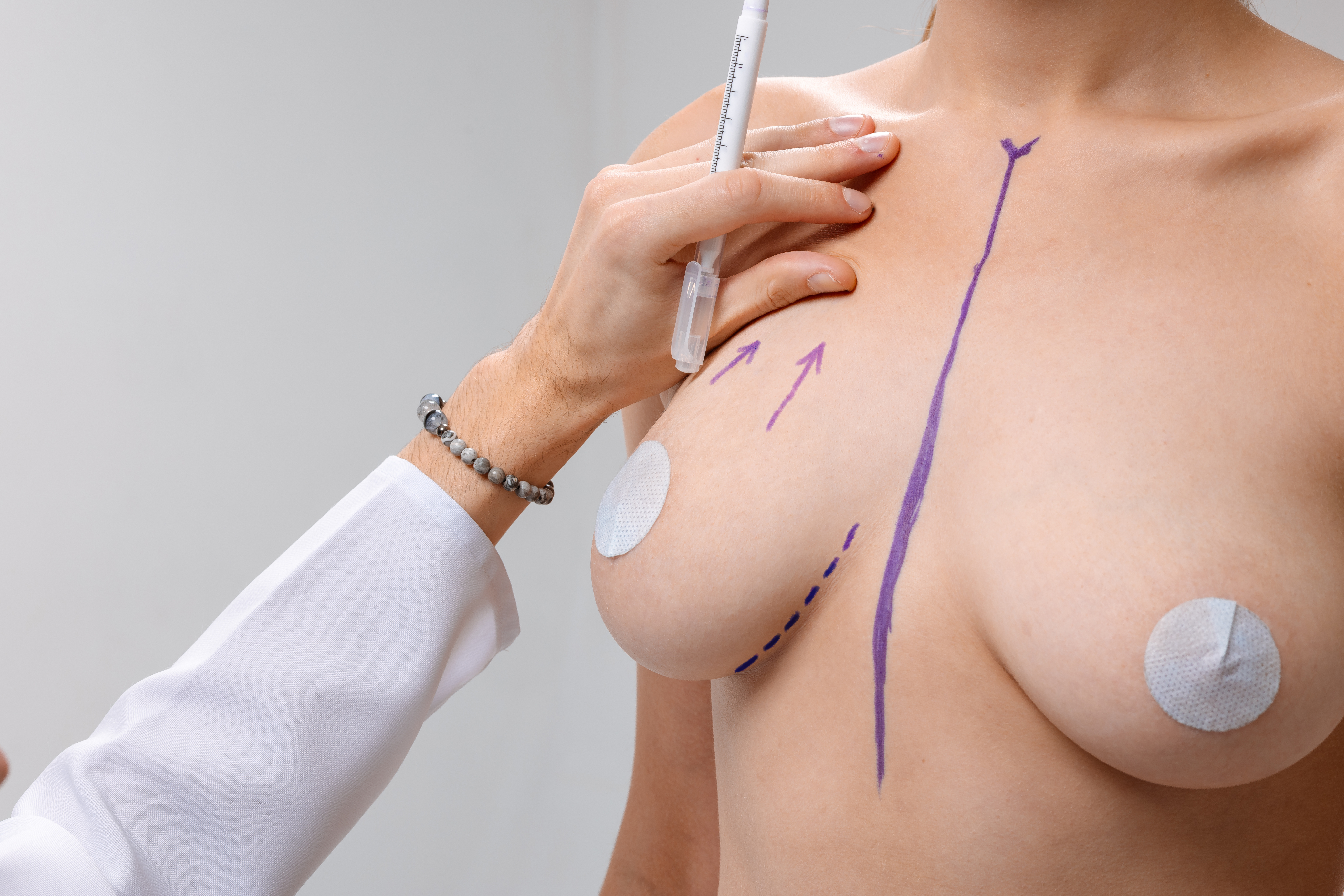 Restoring Your Shape: The Essential Guide to Breast Lifts After Major Weight Loss Restoring Your Shape: The Essential Guide to Breast Lifts After Major Weight Loss